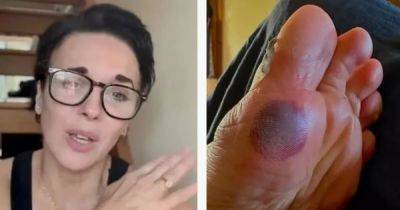 Strictly Come Dancing stars beset by injuries days before show launch as fans beg for 'blister gate' update - www.manchestereveningnews.co.uk