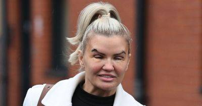 Kerry Katona can barely open her eyes as she's pictured following shock surgery - www.ok.co.uk