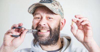 'I pulled my own tooth out with a pair of pliers because I couldn't get a dentist appointment' - www.manchestereveningnews.co.uk