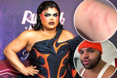 ‘RuPaul’s Drag Race’ alum Kandy Muse assaulted at club: ‘NO IS NO!’ - nypost.com - New York
