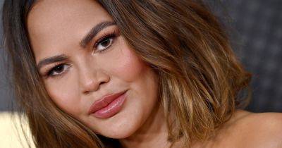 Chrissy Teigen shares 'crazy' results of eyebrow transplant – as hair is taken from back of head and stitched to face - www.ok.co.uk