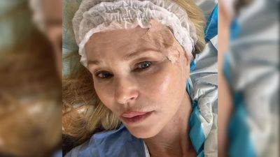 Christie Brinkley Shares Photo After Skin Cancer Procedure: “Stitched Me Up To Perfection Like An Haute Couture Dior” - deadline.com