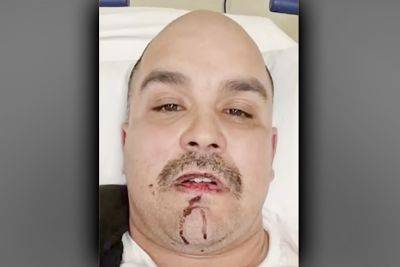 Hollywood Man Assaulted While Attacker Screams, “Die, F****t, Die!” - www.metroweekly.com - Santa Monica - city Hancock