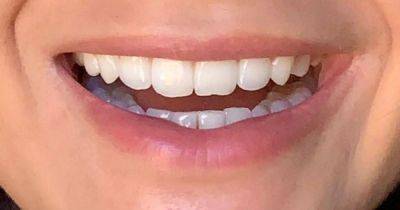 'Miracle' teeth whitening powder that 'reverses' stains after one treatment is on sale - www.ok.co.uk