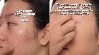 How to Cover Acne With Makeup? Try Concealer Sandwiching - www.glamour.com - city Sandwich