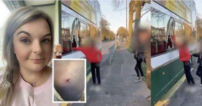 Feral yobs attack and bite NHS worker after smashing up bus - www.dailyrecord.co.uk