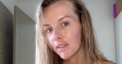 Love Island's Faye Winter emotional as she goes makeup and filter free in video after skin procedure - www.ok.co.uk